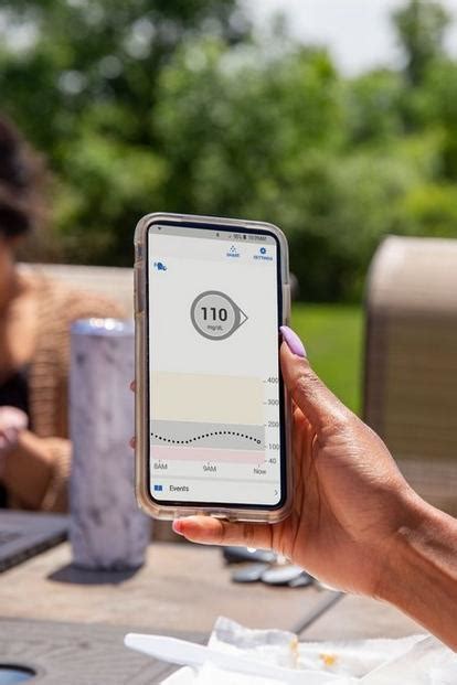 Image result for Dexcom.com Tech Support