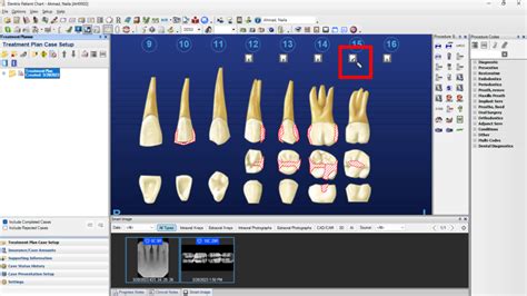 Image result for Dentrix Charting Tutorial