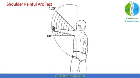 Afbeeldingsresultaten voor Lag Test Shoulder Pain
