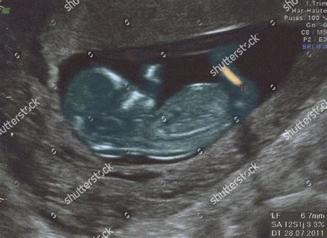 Afbeeldingsresultaten voor Ultrasound ID Code Roblox