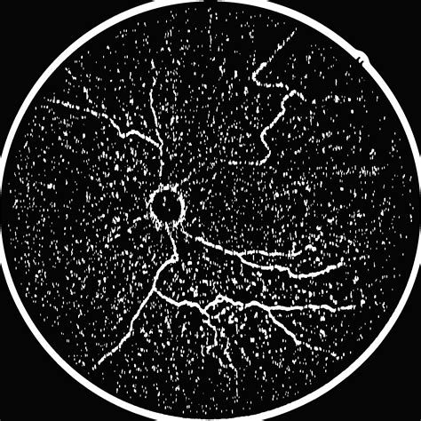 Toradh íomhá ar Salt and Pepper Noise Python
