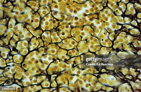 Afbeeldingsresultaten voor Reticular Connective Tissue