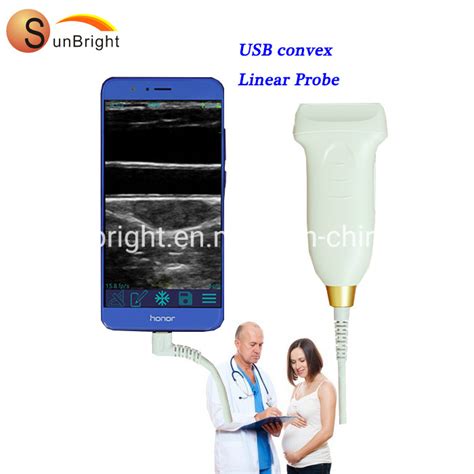 Image result for iPhone Ultrasound Probe