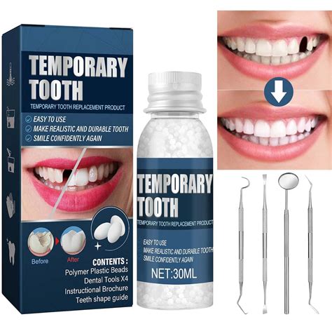Temporary Tooth Repair Kit に対する画像結果