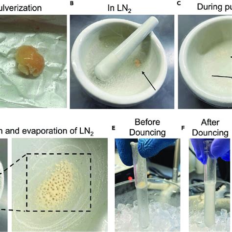 Afbeeldingsresultaten voor Wat Adipose Tissue