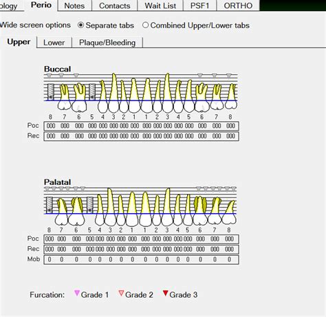 Toradh íomhá ar Perio Protocol Flow Chart