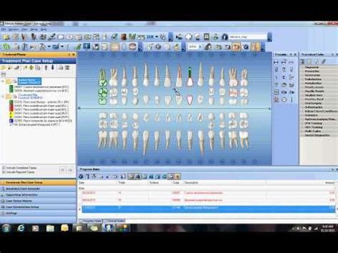 Image result for Dentrix Charting Tutorial