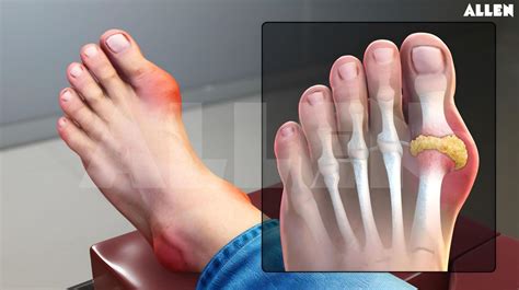 Toradh íomhá ar Smooth Muscle Animation