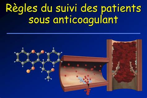 International Normalized Ratio INR に対する画像結果