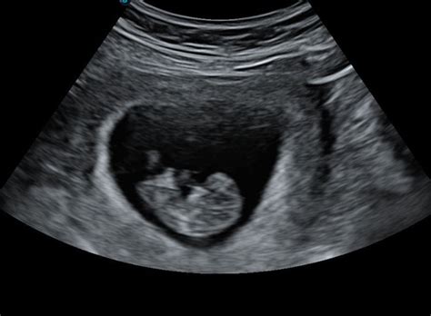 Afbeeldingsresultaten voor Ultrasound ID Code Roblox