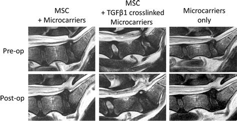 Modic III に対する画像結果