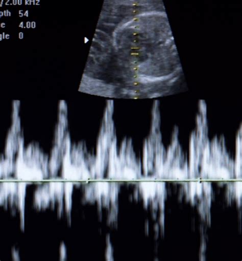 Afbeeldingsresultaten voor Ultrasound ID Code Roblox