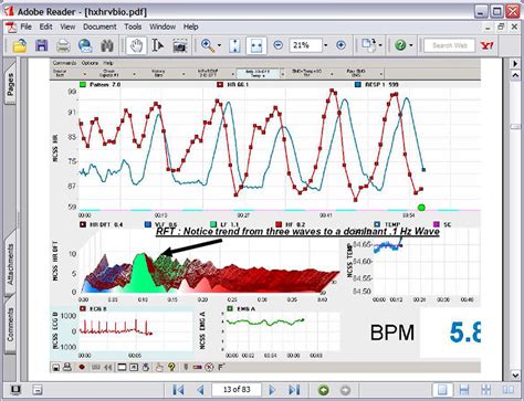 Heart Rate Variability Biofeedback-এর ছবি ফলাফল