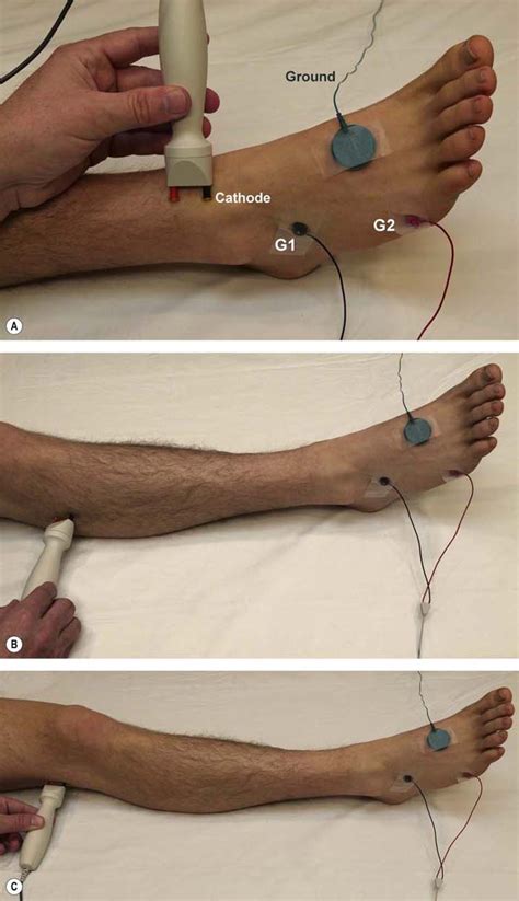 Nerve Conduction Study for Leg に対する画像結果