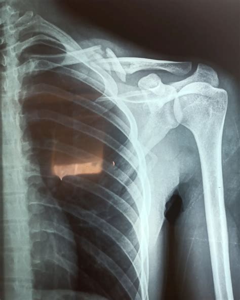 Afbeeldingsresultaten voor Instagram Dous