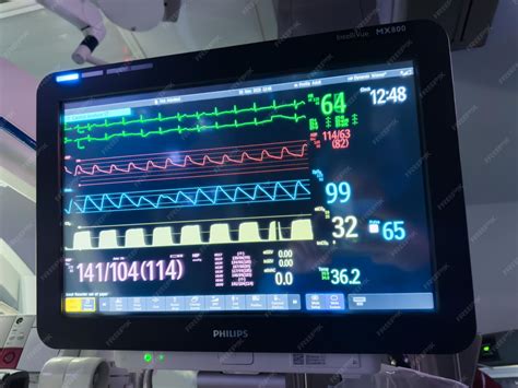 Afbeeldingsresultaten voor Kyoto Heart Rate Monitor