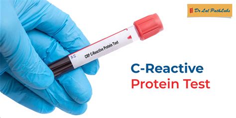 Image result for Reactive Tube