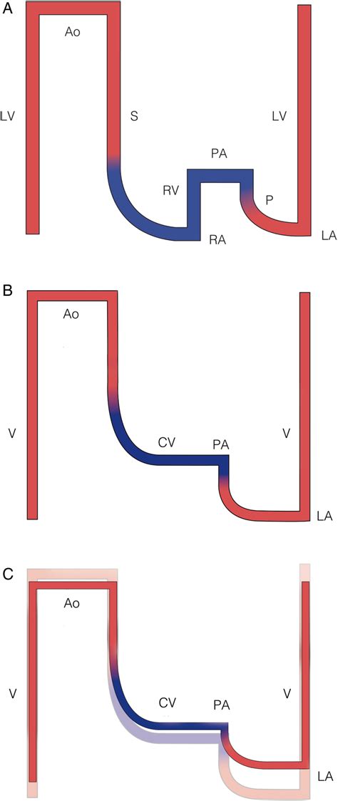 Image result for Normal Line Diagram Circulation