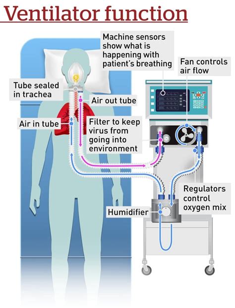 Image result for How Does Ventilator Work