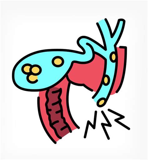 Image result for Gallbladder Skin Rash