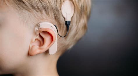 Toradh íomhá ar 3D Bionic Ear