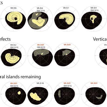 Image result for Aion Visual Field