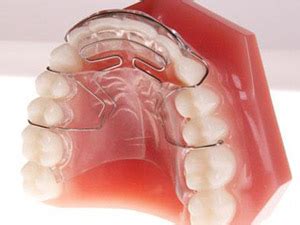 Image result for Top Teeth Retainer