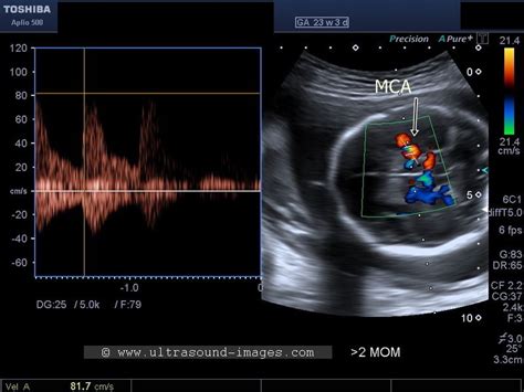 Afbeeldingsresultaten voor Ultrasound ID Code Roblox