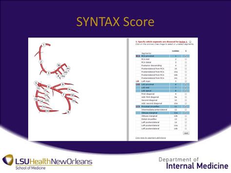 Image result for Syntax Score Chart