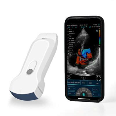 Image result for iPhone Ultrasound Probe
