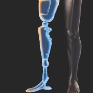 Bionic Body Parts に対する画像結果