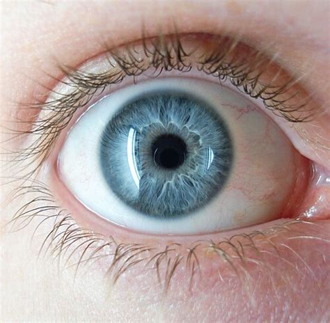 Eye Color Different に対する画像結果