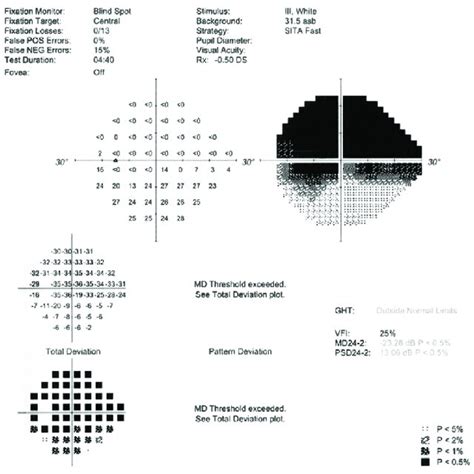 Image result for Aion Visual Field