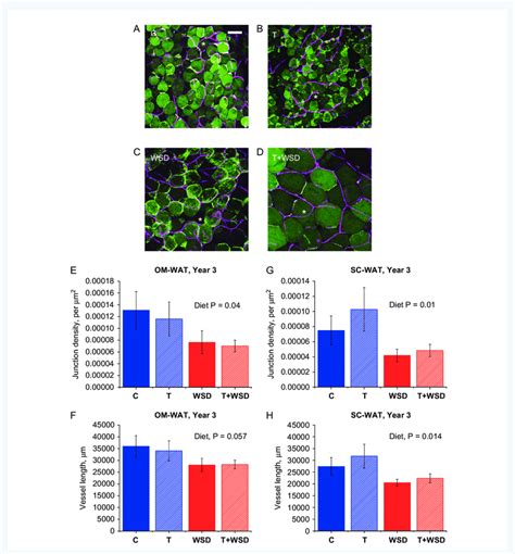 Afbeeldingsresultaten voor Wat Adipose Tissue