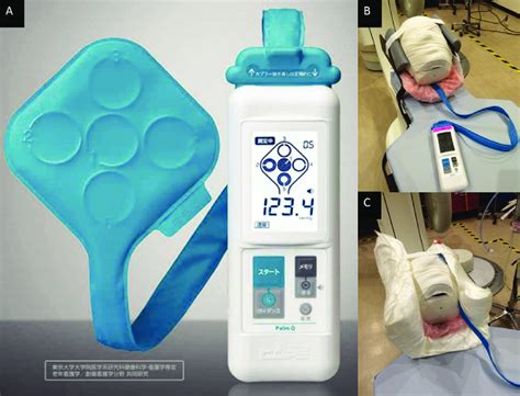 Palm Pressure Sensor に対する画像結果