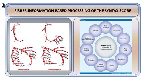 Image result for Syntax Score Chart