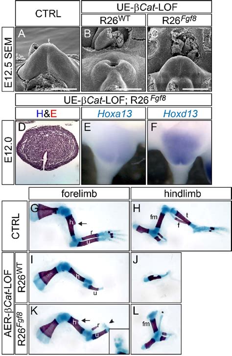 Genital Tubercle に対する画像結果