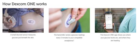 Image result for Dexcom One Arm