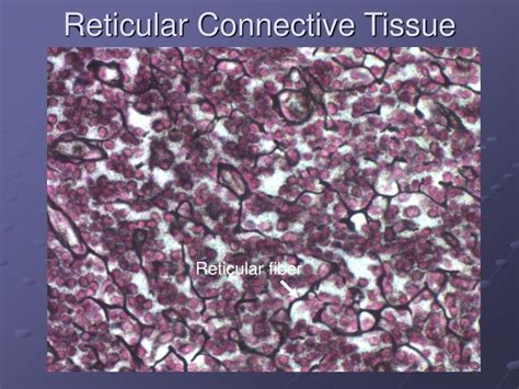 Afbeeldingsresultaten voor Reticular Connective Tissue