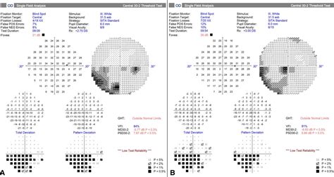 Image result for Aion Visual Field