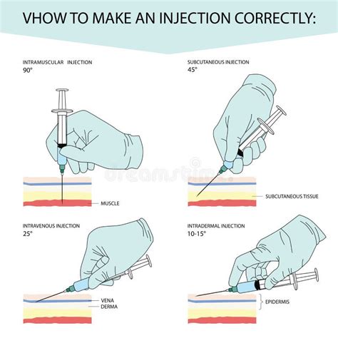 Image result for CIT Injection Mod How to Make a Injection