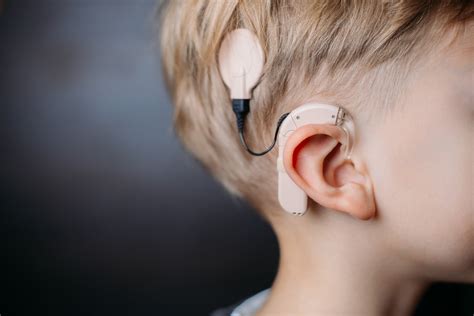 Afbeeldingsresultaten voor Streaming N7 Cochlear Implant to Computer