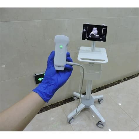 Image result for iPhone Ultrasound Probe