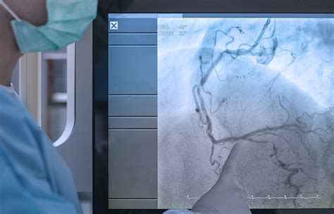 Heart Cath Lab Procedure എന്നതിനുള്ള ഇമേജ് ഫലം