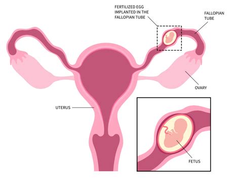 Image result for Female Reproductive System Fetus