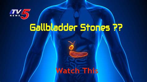 Image result for Gallbladder Skin Rash
