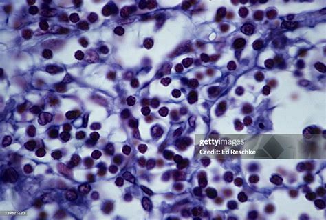 Afbeeldingsresultaten voor Reticular Connective Tissue