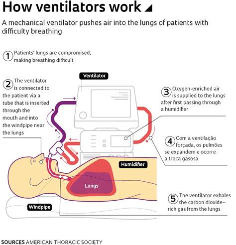 Image result for How Does Ventilator Work