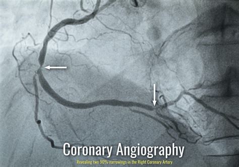 Angiography に対する画像結果