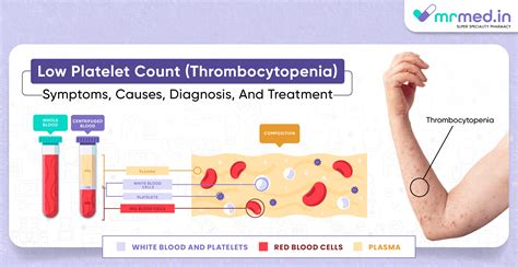 Toradh íomhá ar Normal Blood Platelet Count